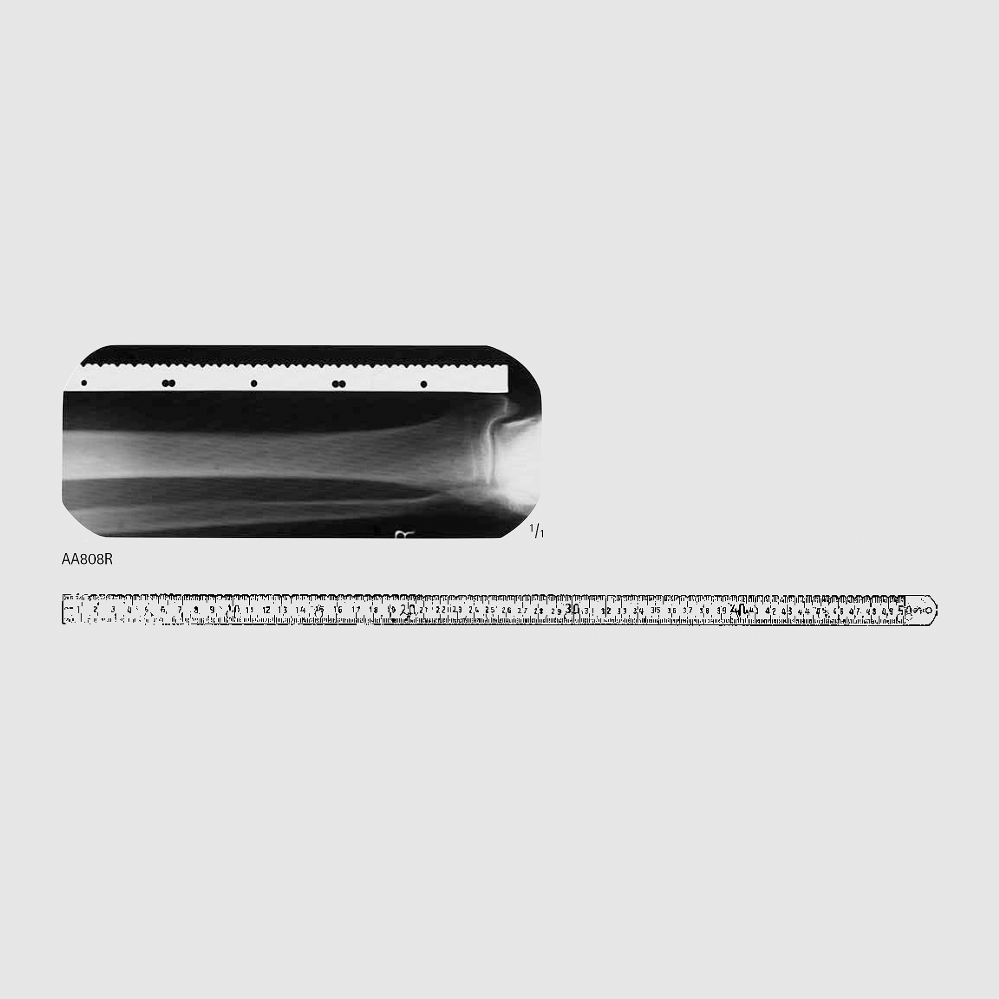 Ruler, F/ X-Ray Work – Dr. Simon